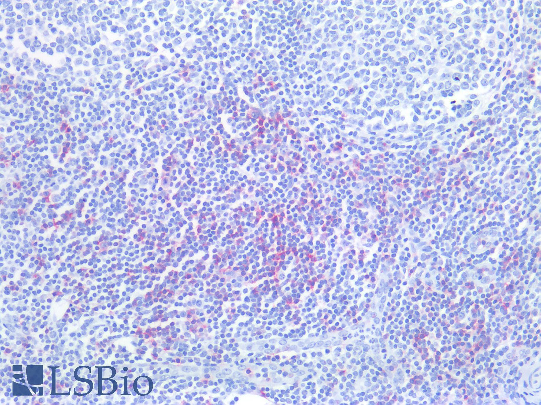 PathPlus™ Polyclonal Rabbit anti-Human CD8A / CD8 Alpha Antibody (clone P17-V, C-Terminus, IHC)
