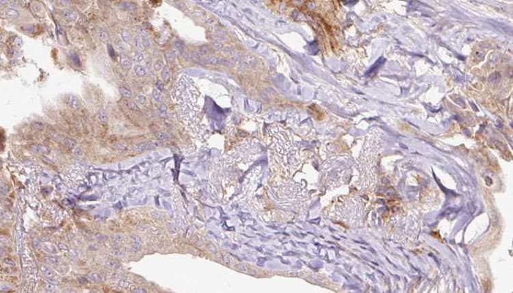 RAB3A Antibody (aa1-20)