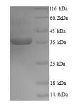 Zaire Ebolavirus Minor NucleoProtein VP30 (Recombinant 6His, N-terminus)