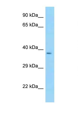 CYTIP Antibody (aa58-107)