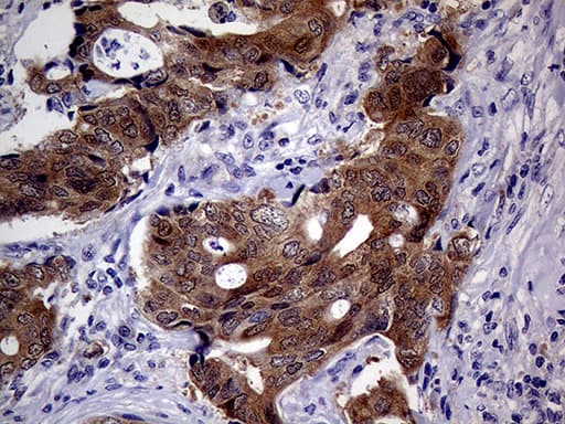 p16INK4a / CDKN2A Antibody (clone OTI11D3)
