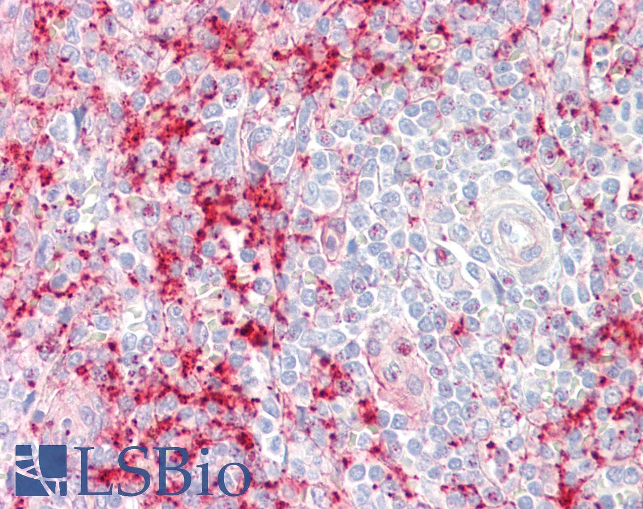 IHC-plus™ Polyclonal Rabbit anti-Human SEPT1 / Septin 1 Antibody (IHC, IF, WB)