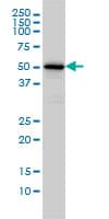 IHC-plus™ CAMKK1 Antibody (clone 1F6)