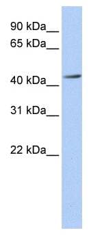 Polyclonal Rabbit anti-Human ACAA1 Antibody (aa36-85, IHC, WB)