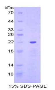 Mouse PON1 / ESA Protein (Recombinant His)