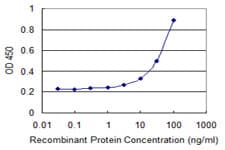 Monoclonal Mouse anti-Human ERdj4 / DNAJB9 Antibody (clone 3G4, IF)