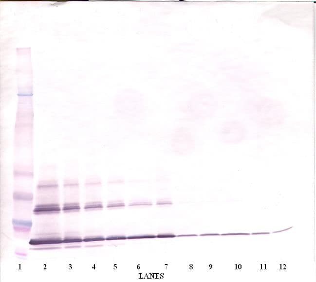 IHC-plus™ Polyclonal Goat anti-Human CD40L Antibody (IHC, WB)