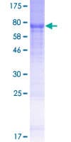 Human MLZE Protein (Recombinant GST)