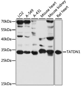 TATDN1 Antibody