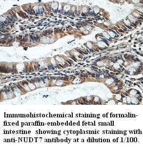 Polyclonal Rabbit anti-Human NUDT7 Antibody (IHC, WB)