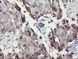 SNAI2 / SLUG Antibody (clone OTI16G7)