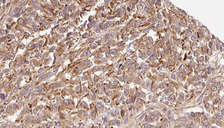 CST7 / Cystatin F Antibody