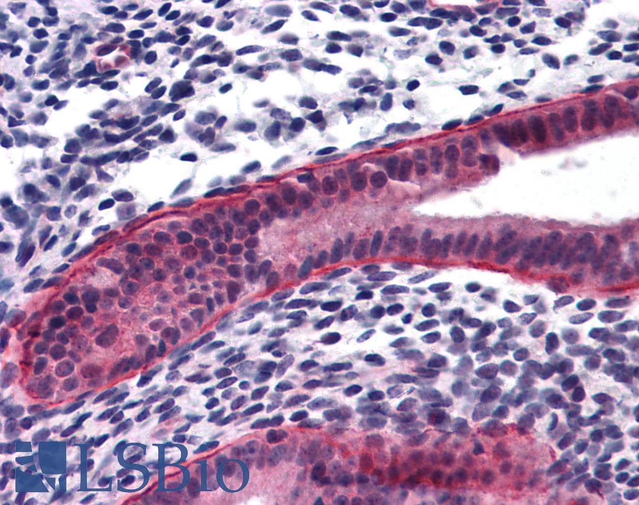 IHC-plus™ PTCHD2 Antibody