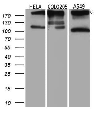 IQGAP1 Antibody (aa464-609, clone OTI6E1)