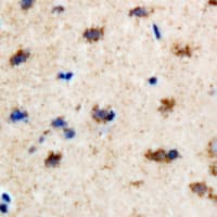 EFHC1 Antibody