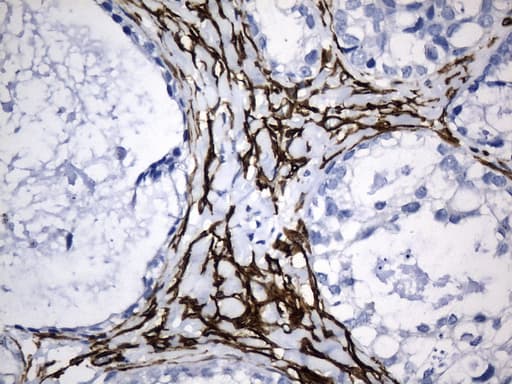 ACTA2 / Smooth Muscle Actin Antibody (N-Terminus, clone UMAB237)