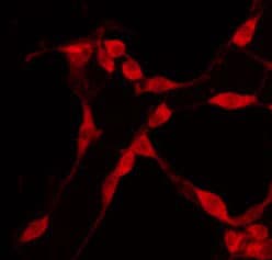 AVEN / PDCD12 Antibody