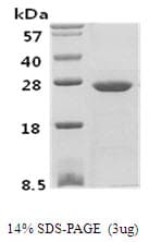 Human PSPH Protein (Recombinant)