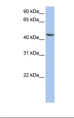 ALDH3B1 Antibody (N-Terminus)