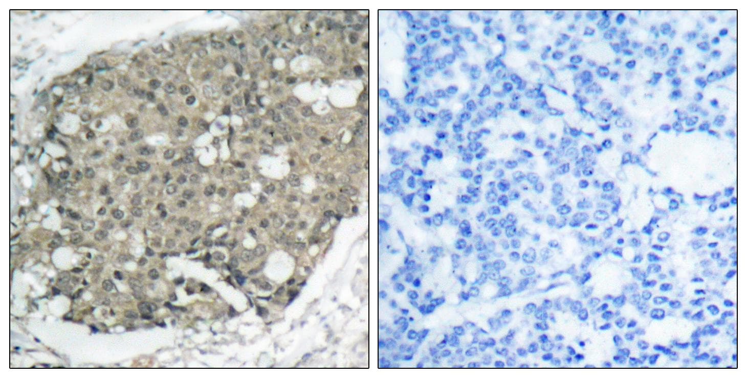 AKT1 Antibody (p308)