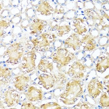 MAS1 / MAS Antibody