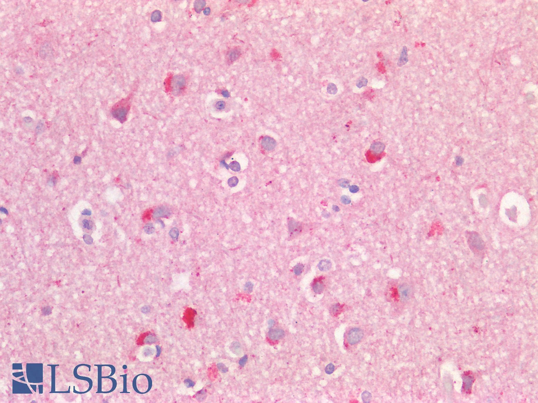 GPR49 / LGR5 Antibody (N-Terminus)