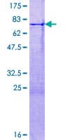 Human DMBX1 / OTX3 Protein (Recombinant GST)