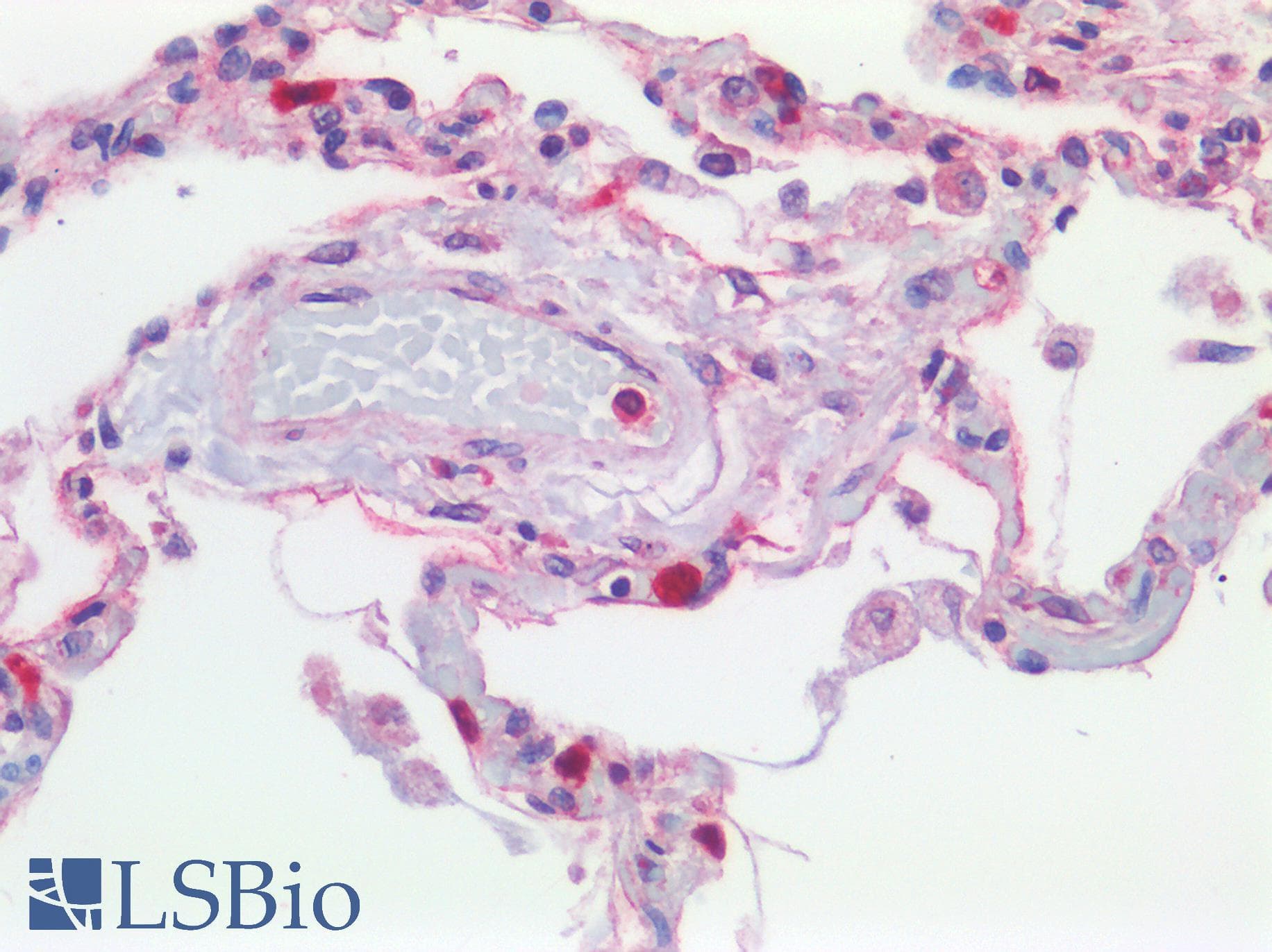 IHC-plus™ FPR1 / FPR Antibody (aa155-204)