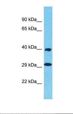 Polyclonal Rabbit anti-Human OR1N2 Antibody (C-Terminus, WB)