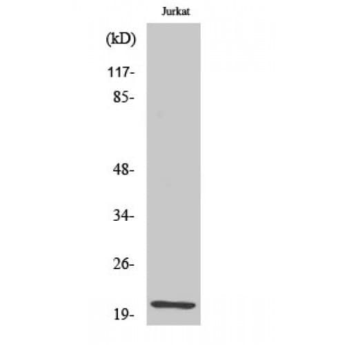 Polyclonal Rabbit anti-Human HEN1 + HEN2 Antibody (10-90 aa, Internal, IHC, WB)