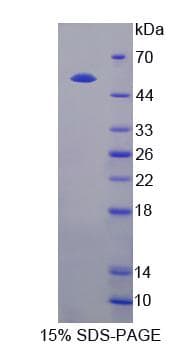 Human GDA / Nedasin Protein (Recombinant His-S)