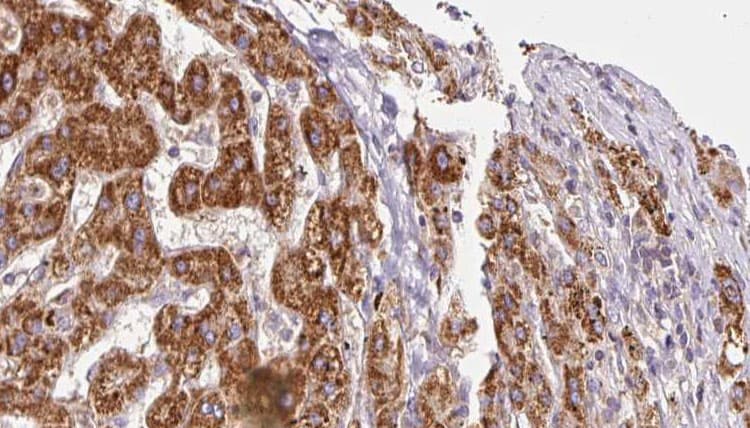 Polyclonal Rabbit anti-Human ITGA6/Integrin Alpha 6/CD49f Antibody (IHC, WB)
