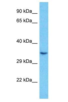RNF2 / RING2 / RING1B Antibody (aa156-205)