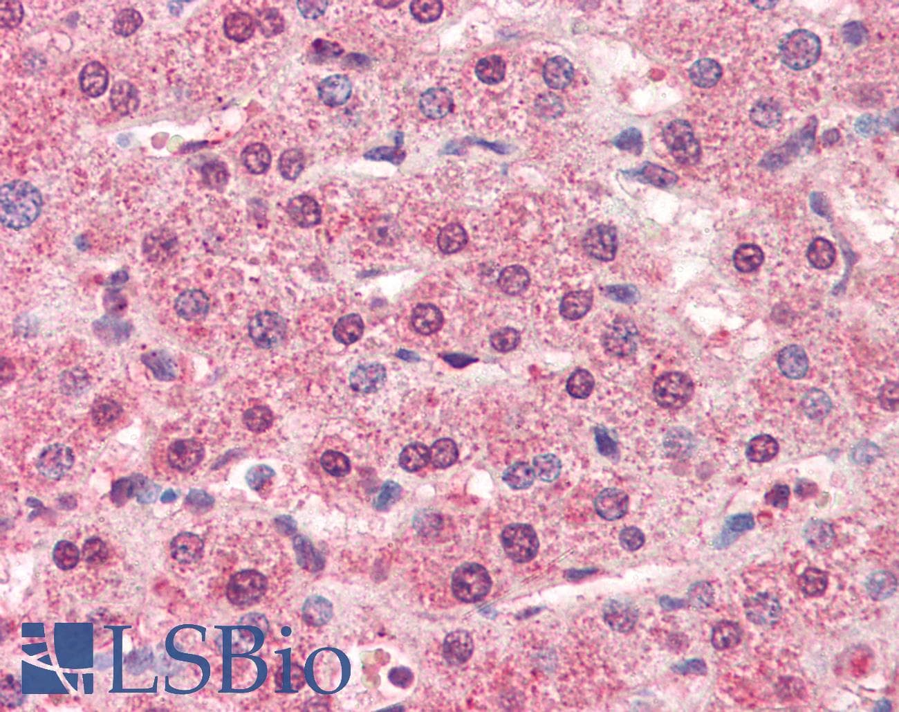 IHC-plus™ Monoclonal Mouse anti-Human CTSL / Cathepsin L Antibody (clone 2H7, aa114-333, IHC, WB)