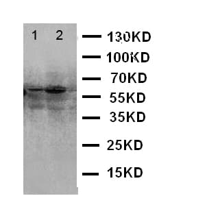 Polyclonal Rabbit anti-Human E2F1 Antibody (aa246-260, WB)