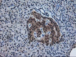 PDXK / PNK Antibody (clone OTI5H5)