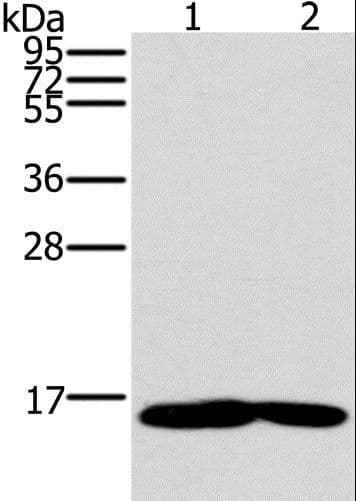 MB / Myoglobin Antibody