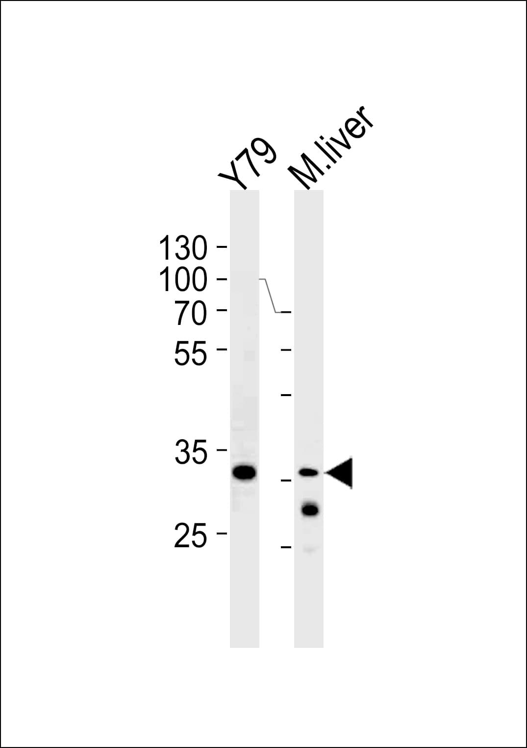 Polyclonal Rabbit anti-Human YBX3 / CSDA Antibody (aa152-181, WB)