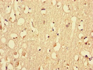 MYH3 Antibody