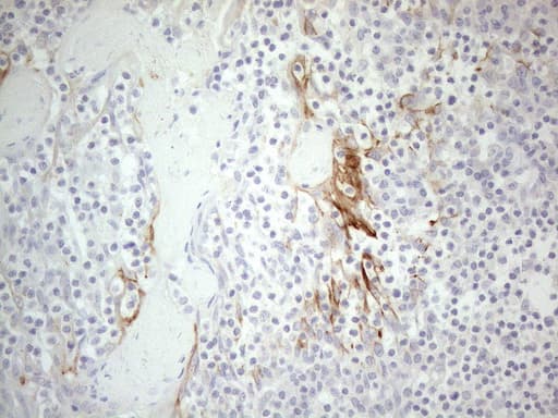 ERBB3 / HER3 Antibody (aa983-1342, clone OTI3C1, Carrier-free)