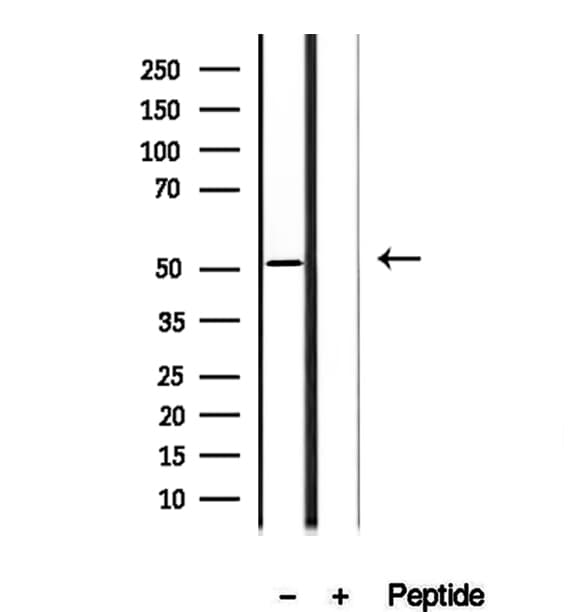 AEBP2 Antibody