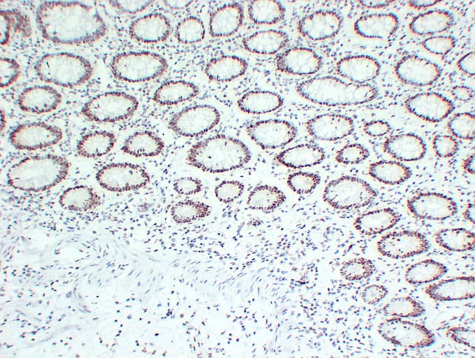 Monoclonal Mouse anti-Human MLH1 Antibody (clone ABT-MLH1, IHC, WB)