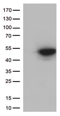 CDK15 / ALS2CR7 Antibody (aa293-378, clone OTI3C1, Carrier-free)