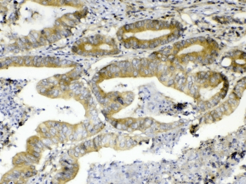 ERBB4 / HER4 Antibody