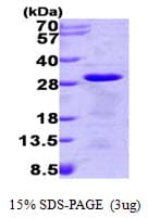 Human TPT1 / TCTP Protein (Recombinant His)