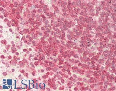 IHC-plus™ ARL6 Antibody