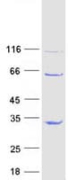 Human HCA557B / METTL21A Protein (Recombinant Myc-DDK (Flag))