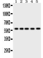 OCLN / Occludin Antibody (aa373-522)