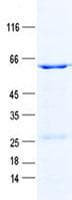 Human SETD4 Protein (Recombinant GST, N-terminus + His, C-terminus)