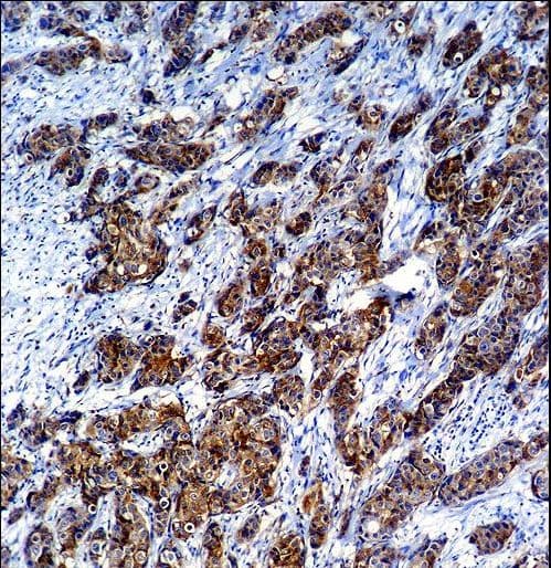 LGALS3 / Galectin 3 Antibody (aa163-191)
